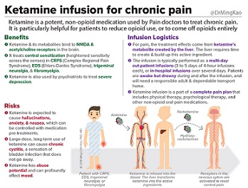 Ketamine Infusions